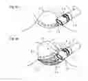 Fig. 05 - Endoscope hood and endoscope with the same mounted thereon