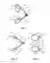 Fig. 02 - Speculum