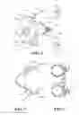 Fig. 03 - Speculum