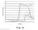 Fig. 11 - Adaptive Processing of Ambulatory Electrocardiogram Signals