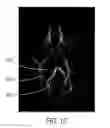 Fig. 19 - Surgical access assembly and method of using same