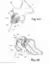 Fig. 04 - EM tracking systems for use with ultrasound and other imaging modalities
