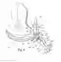 Fig. 06 - EM tracking systems for use with ultrasound and other imaging modalities