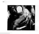 Fig. 05 - Method and system for automatic native and bypass coronary ostia detection in cardiac computed tomography volumes