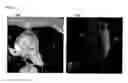 Fig. 07 - Method and system for automatic native and bypass coronary ostia detection in cardiac computed tomography volumes