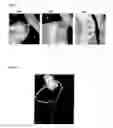 Fig. 10 - Method and system for automatic native and bypass coronary ostia detection in cardiac computed tomography volumes