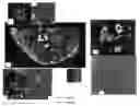 Fig. 01 - DEVICE AND METHOD FOR WIDE-FIELD AND HIGH RESOLUTION IMAGING OF TISSUE