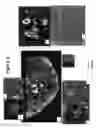 Fig. 04 - DEVICE AND METHOD FOR WIDE-FIELD AND HIGH RESOLUTION IMAGING OF TISSUE