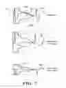 Fig. 08 - Patient Screening Tools for Implantable Cardiac Stimulus Systems