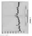 Fig. 12 - Detecting or validating a detection of a state change from a template of heart rate derivative shape or heart beat wave complex