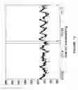 Fig. 15 - Detecting or validating a detection of a state change from a template of heart rate derivative shape or heart beat wave complex