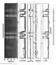 Fig. 10 - Cough Analysis