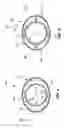 Fig. 05 - Retractable needle-safety blood sampling device