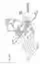 Fig. 27 - Systems, devices, and methods for mechanically reducing and fixing bone fractures