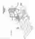 Fig. 29 - Systems, devices, and methods for mechanically reducing and fixing bone fractures