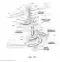 Fig. 49 - Systems, devices, and methods for mechanically reducing and fixing bone fractures