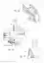 Fig. 52 - Systems, devices, and methods for mechanically reducing and fixing bone fractures