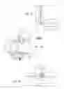 Fig. 57 - Systems, devices, and methods for mechanically reducing and fixing bone fractures