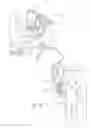 Fig. 63 - Systems, devices, and methods for mechanically reducing and fixing bone fractures