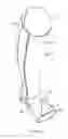Fig. 02 - Orthotic sock