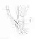 Fig. 03 - Ocular implant systems