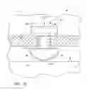 Fig. 23 - Ocular implant systems