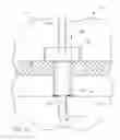 Fig. 24 - Ocular implant systems