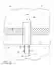Fig. 25 - Ocular implant systems