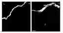 Fig. 01 - Photodynamic therapy including light pretreatment