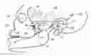 Fig. 01 - Stimulation method for the sphenopalatine ganglia, sphenopalatine nerve, or vidian nerve for treatment of medical conditions