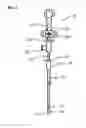 Fig. 03 - Methods and systems for submucosal implantation of a device for diagnosis and treatment with a therapeutic agent