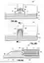 Fig. 10 - Methods and systems for submucosal implantation of a device for diagnosis and treatment with a therapeutic agent