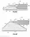 Fig. 11 - Methods and systems for submucosal implantation of a device for diagnosis and treatment with a therapeutic agent