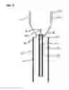 Fig. 12 - Methods and systems for submucosal implantation of a device for diagnosis and treatment with a therapeutic agent
