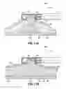 Fig. 14 - Methods and systems for submucosal implantation of a device for diagnosis and treatment with a therapeutic agent