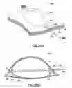 Fig. 31 - Methods and systems for submucosal implantation of a device for diagnosis and treatment with a therapeutic agent