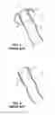 Fig. 02 - SOLUBLE MATERIAL INSERTION AID FOR BALLOON CATHETER