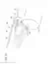 Fig. 20 - Dual chamber syringe with retractable needle