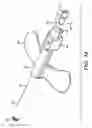 Fig. 13 - NEEDLE-BASED MEDICAL DEVICE WITH NEEDLE SHIELD