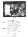 Fig. 64 - Controlled negative pressure apparatus and absorbency mechanism