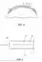 Fig. 03 - Medical Tool Deflection and Resistant Surgical Sponge