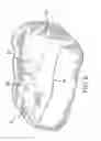 Fig. 06 - Diaper with hand receiving pocket