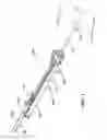 Fig. 02 - Medical device and method for treatment of a sinus opening