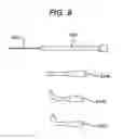 Fig. 10 - Medical device and method for treatment of a sinus opening