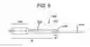 Fig. 11 - Medical device and method for treatment of a sinus opening