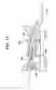 Fig. 15 - Medical device and method for treatment of a sinus opening
