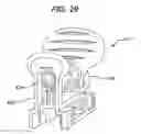 Fig. 31 - Medical device and method for treatment of a sinus opening