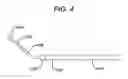 Fig. 05 - METHODS AND APPARATUS FOR TREATING DISORDERS OF THE SINUSES