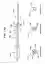 Fig. 18 - METHODS AND APPARATUS FOR TREATING DISORDERS OF THE SINUSES