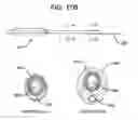 Fig. 19 - METHODS AND APPARATUS FOR TREATING DISORDERS OF THE SINUSES
